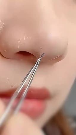 German Ultra-fine No. 5 Cell Pimples Blackhead Clip Tweezers Beauty Salon Special Scraping & Closing Artifact Acne Needle Tools