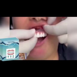 2026 Adjustable Silicone Denture Kit - Soft Liners Temporary Teeth Set for Men & Women, Natural & Safe