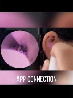 Generation-2, Visual Ear Wax Cleaner Camera Safe Earwax Removal Endoscope Ear Cleaning Tools Ear Care, Black, White Styles, Hot