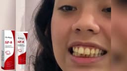 Sp-8 Probiotic Toothpaste Whitening Tooth Remove Plaque Stains Teeth Whitener Oral Hygiene Clean Fresh Breath Dental Brighten