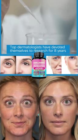 90 Caps Hydrolyzed Collagen Capsules,Remove Spots Wrinkle Eye Bags, Anti-Aging,NAD+ Supplement,Skin Care Repair for Women