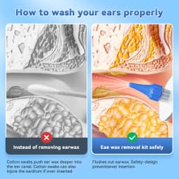 Ear Wax Removal Manual Ear Cleaner Water Earwax Removal Kit Ear Irrigation Flushing System Ear Cleaning Kit Safe and Effective