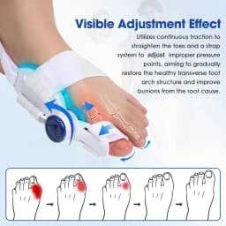 Toe Splint Bunion Adjuster with Cooling Pad Adjustable Big Toe Valgus Support Tool for Both Feet Straightening Orthopedic Thumb