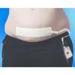 10X20CM 15x20cm Negative pressure wound therapy system VAC NPWT device with dressing kit medical dressing