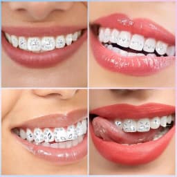 1350pcs Tooth Gem Kit Various Shapes Fashionable Teeth Jewelry Gem Personalized Dental Decoration for Girls Boys Party Decor