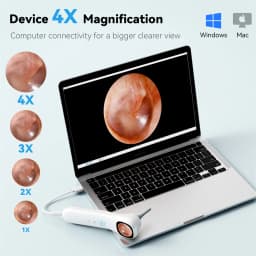 5-in-1 Smart Detector with Screen 1080P HD Ear Camera Includes Ear Pick Set and Six Replacement Tips 12 Extra Inspection Heads