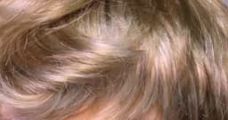 Blythes Doll Wig Fits Into the 1/6 Style Male European Style Curly Hair With Highlights Dark Brown Mixed Light Imitation Mohair