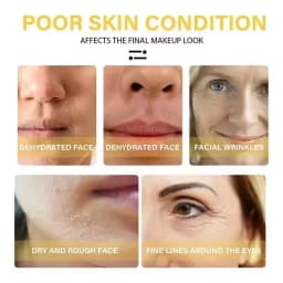 Instant Collagen Protein Threads Lifting Firming Absorbable Face Filler Anti-aging Deep Repair Fade Fine Lines Korean Skincare