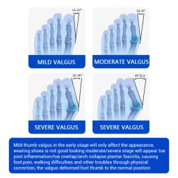 Unisex Bunion Foot Adjuster Rotating Knob Hallux Valgus Splint Big Toe Straightener Brace with Heel Strap for Left Right Foot