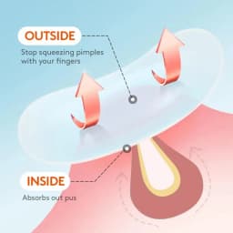 Acne Patch Hydrocolloid Salicylic Acid Tea Tree Oil For Inflamed Acne Improve Whiteheads Pimple Patches Face Spot Makeup Tools