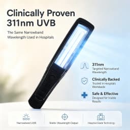 Home Use 311nm UVB Light Therapy Device Hospital Grade Skin Irradiation Machine One Button Operation