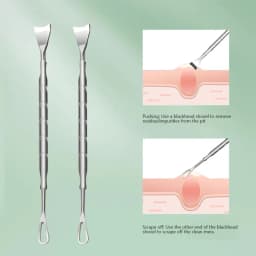 Blackhead Remover Pimple Popper Tool Acne Needle Removing Treatment Comedone Whitehead Popping Zit Nose Face Blemish Extractor