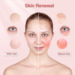 Red Light Therapy Photon Mask Hello Face M500S LED 630nm 850nm Near-Infrared Light Therapy Facial Mask Professional Beauty Care