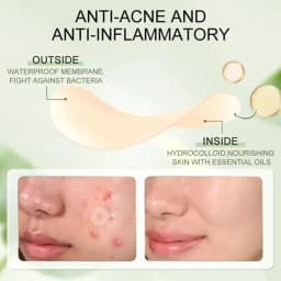 Acne Patch Hydrocolloid Salicylic Acid Tea Tree Oil For Inflamed Acne Improve Whiteheads Pimple Patches Face Spot Makeup Tools