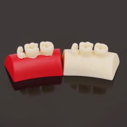 Dental Inlay Exercise Model Block Composite Resin Filling Practice Models Dentistry Oral Teeth Teaching Typodont Study