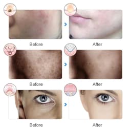 LED Face Mask Light Therapy 7 Colors Light Therapy Mask Skin Rejuvenation Tightening for Skin Care Anti Acne Wrinkles Whitening