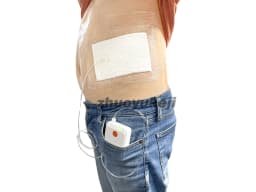 Negative Pressure Wound Therapy System VAC NPWT Device with Dressing Kit Medical Dressing