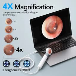 Smart Ear Camera Endoscope 90° Rotatable Head for Easy Viewing 1080P HD Camera with 12 Replacement Heads Included /Nose /Skin