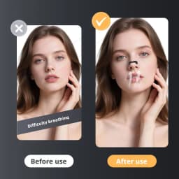 Nasal Dilator Sleep Nasal Breathing Dilators Starter Kit Nose Breathe Strips Nasal Strips Reduce Snoring Increase Air