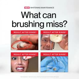 Hismile ID Mouthwash Teeth Whitening Stain Removal Deep Clean Fresh Breath Daily Oral Care