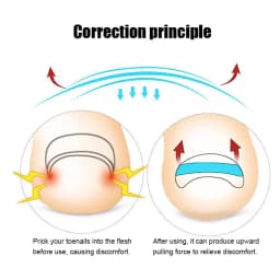 10pc/box Ingrown Toenail Correction Tool Straightening Clip Brace Ingrown Toe Nail Treatment Elastic Patch Sticker Pedicure Tool