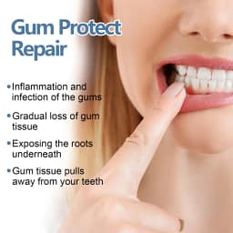 Rapid Repair Gums Gel Effectively Relieve Tooth Allergy Dental Caries Tooth Cleaning Toothpaste Relieve Tooth Damage Serum