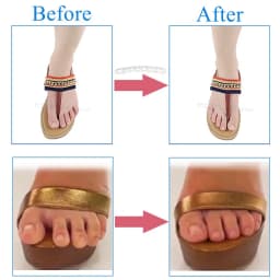 Silicone Pads for Women's Shoes Non-slip Inserts Self-adhesive Forefoot Heel Gel Insoles for Heels Sandals Anti-Slip Foot Pad