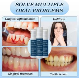 Rapid Gum Repair & Teeth Care Gel – Multi-Purpose Oral Serum for Tooth Sensitivity Stain and Tartar Removal and Deep Cleaning