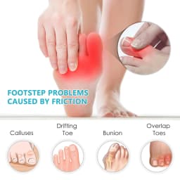 2pcs Transparent Toe Seprateor Hammer Toe Straightener Prevent Toe Overlapping Bunion Thumb Separator Orthotics Foot Care Tool