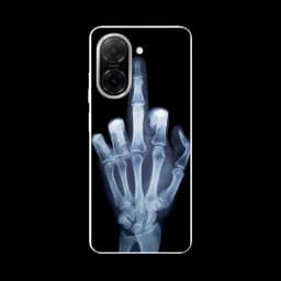 For Redmi A5 NFC Case Football Soft Silicone Back Case For Xiaomi Redmi A5 NFC (173,45mm) Phone Cover Redmi A5NFC etui Fundas