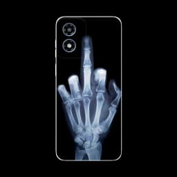 For Moto G 5G 2024 Case Bumper TPU Silicone Soft Back Cover for Motorola Moto G 5G 2024 Cases MotoG (2024) Fundas Cartoon