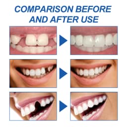 Moldable Fake Teeth Dental Repair Tools Denture Repair Beads for Fixing Filling Missing Broken Tooth High-fitting Dentures