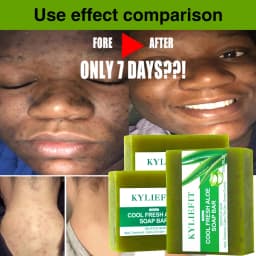 AILKE Aloe Vera Whitening Soap, Remove Acne, Pimples, Skin Radiant, Improve Skin Luster, Vegan Bath Wash for Women and Men, 200g