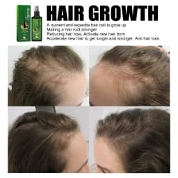 Hair Growth Serum 7 Days Fast Regrowth Essential Capsule Anti Hair loss Baldness Repair Damaged Scalp Treatment For Women Men