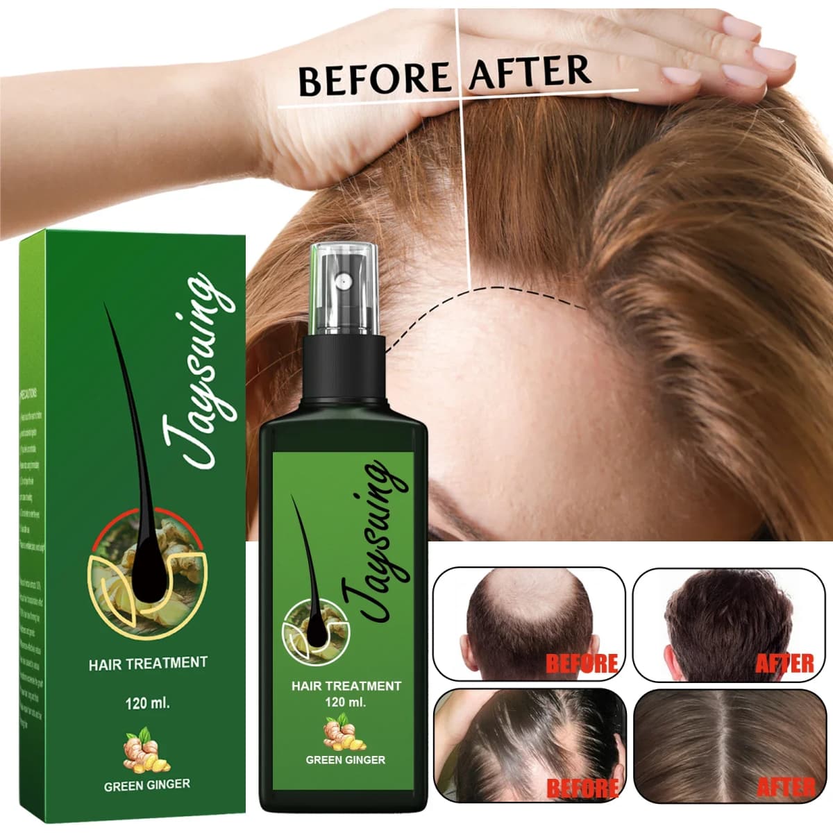 Hair Growth Serum 7 Days Fast Regrowth Essential Capsule Anti Hair loss Baldness Repair Damaged Scalp Treatment For Women Men