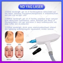 Multifunctional 2in1 Professional Beauty Equipment IPL OPT Hair Removal ND Yag Tattoo Removal Pico Second Machine