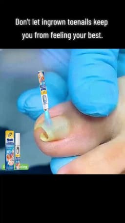 Advanced Laser Pen for Healthy Nail Growth