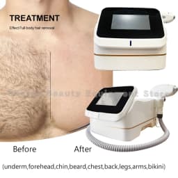 Mini 5000W Diode Laser Hair Removal Machine Ice Cooling Painless Permanent Epilator Portable Professional Salon Beauty Device EU