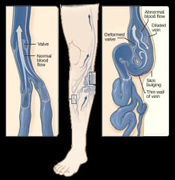Compression Socks 20-30 MMHg Knee High Calf Sleeve Men Best for Running,Athletic,Medical,Varicose Veins,Pregnancy,Travel