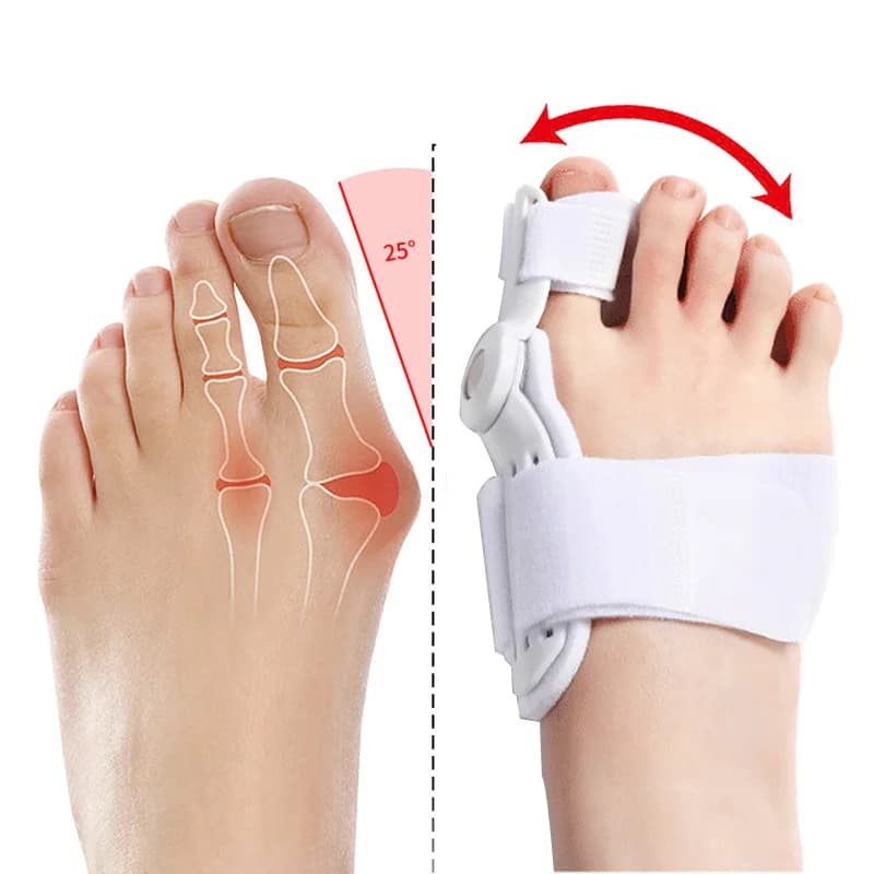 2Pcs Hallux Valgus Corrector Bunions For Toes Corrector Foot Finger Separator Toe Separator Foot Care Haluksy Bunion Corrector