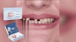 Denture Set False Teeth Top And Bottom Denture Solution Realistic False Teeth Professional Temporary Teeth Kit For Lovers
