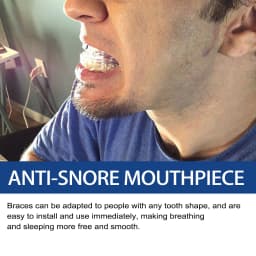 Eelhoe Anti-Snoring Braces Teeth Grinding Breathing Mouthguard Dental Tray Protector Stop Snoring Device Improve Sleep