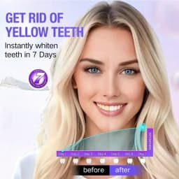 9D Whitener Strips Teeth Brightening Strips White Strips For Teeth Whitening Teeth Effect Oral Tooth Teeth Whitening Strips Gift