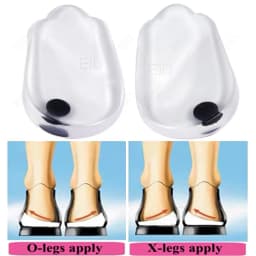 1 Pair Magnets Silicon Orthopedic Insoles Foot Care Tool For Men Women Health Care O/X Type Legs Knee Varus Correction Heel Pads