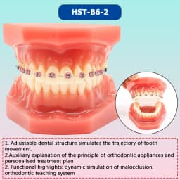 AG Orthodontic Teaching Model Oral Model Half Ceramic Half Metal Bracket for Dentist Doctor-patient Communication Tool