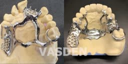 1kg Denture Removable Partial Famework Alloy Dental Lab Chromium Cobalt Alloys CoCr Metal