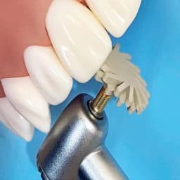 6Pcs Dental Rubber Polisher Composite Resin Diamond Impregnated 2-Step Polishing System RA Disc 14mm Wheel Kit Spiral Flex Brush