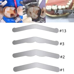 144Pcs Dental Tofflemire Matrix Stainless Steel Sectional Contoured Matrices Matrix Bands #1/#2/#3/#13 Dentistry Materials Tools