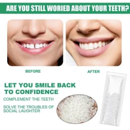 5-100g Moldable False Teeth Tooth Repair Granules Tooth Beads Temporary Filling For Rooth Broken Tooth Repair Kit Thermal Fit