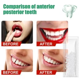 5-100g Moldable False Teeth Tooth Repair Granules Tooth Beads Temporary Filling For Rooth Broken Tooth Repair Kit Thermal Fit